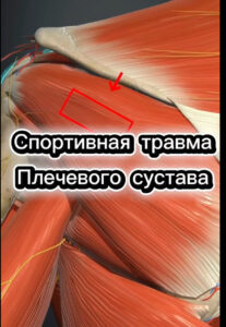 Травма плеча