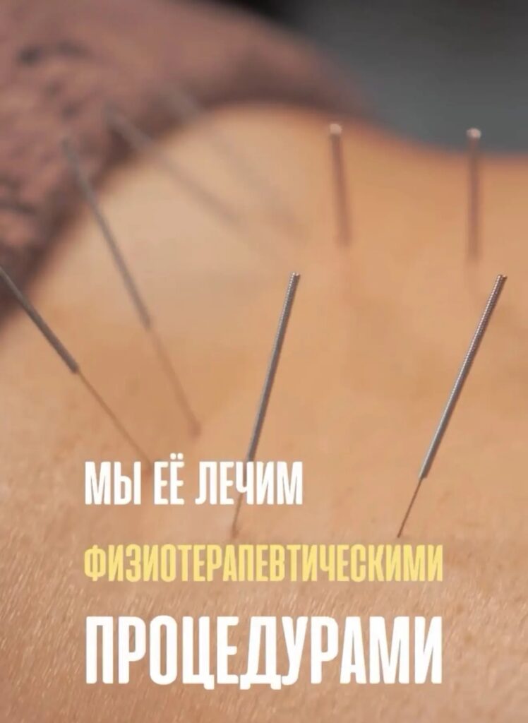 Dry needling с ВТЭС: лечение боли